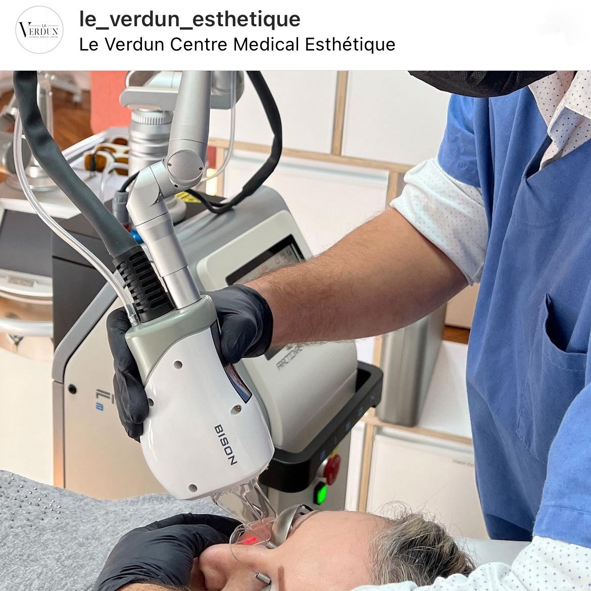 Découvrez plus en détail l'épilation au laser définitive