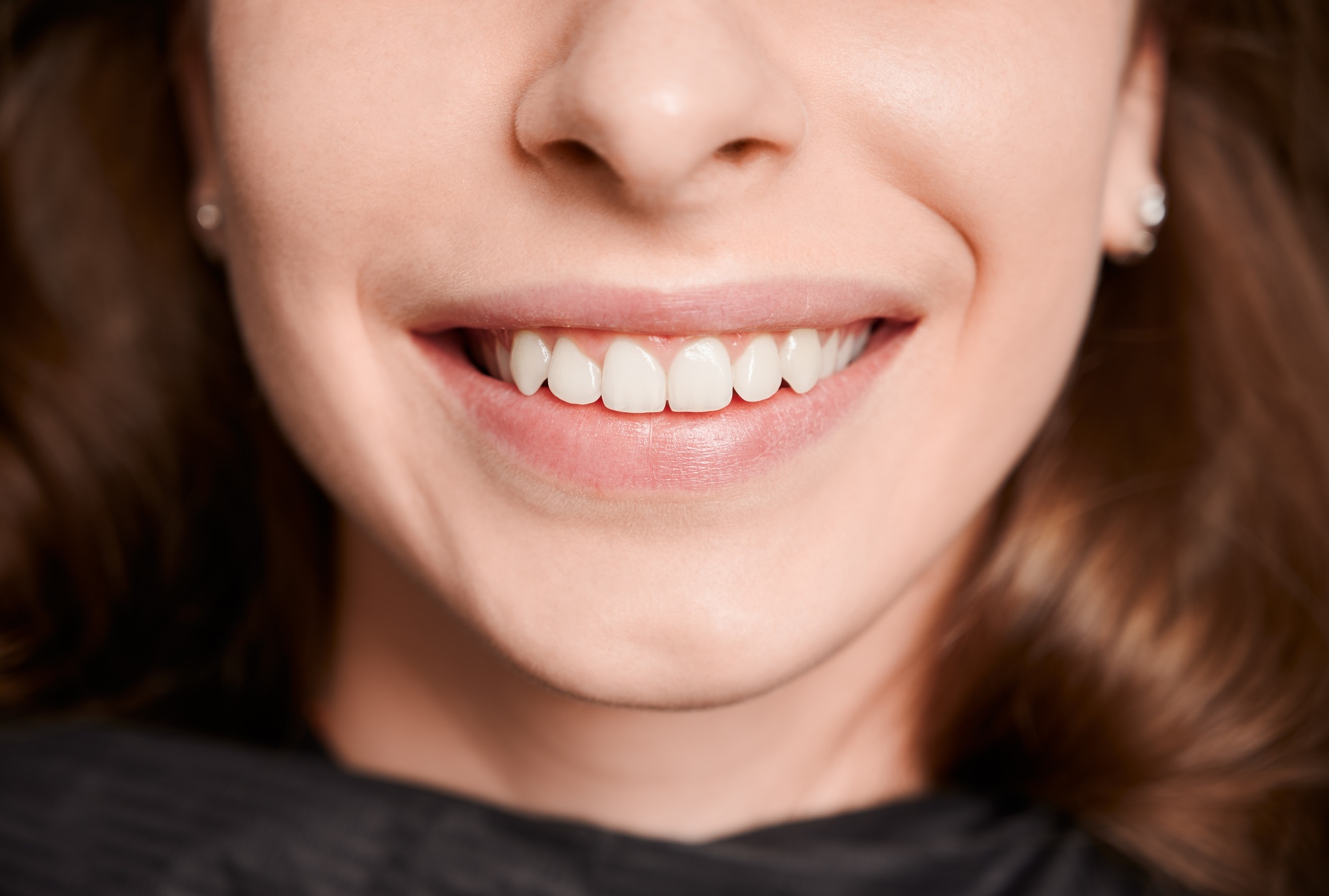 Macro photography of a beautiful female smile with white healthy teeth